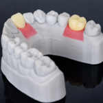 Riton Gingiva Mask Resin 1000g - Image 3