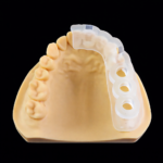 Riton Surgical Guide Resin 1000g - Image 2