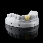Riton Temporary Model Resin 1000g - Image 2