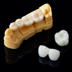 Riton Temporary Model Resin 1000g - Image 3