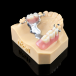 Riton RXT-01 CoCrW Alloy Powder - Image 3